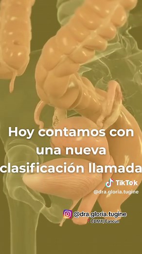 Clasificación Enzian: Comprende tu Endometriosis