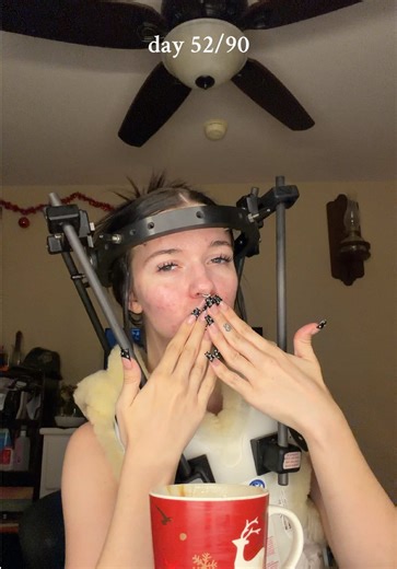 just trying to stay consistent at this point 🥺 #fyp #foryou #spinalcordinjury #halobrace #spinalcordinjuryrecovery