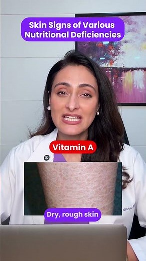 What is your diet missing? Learn about nutritional deficiency