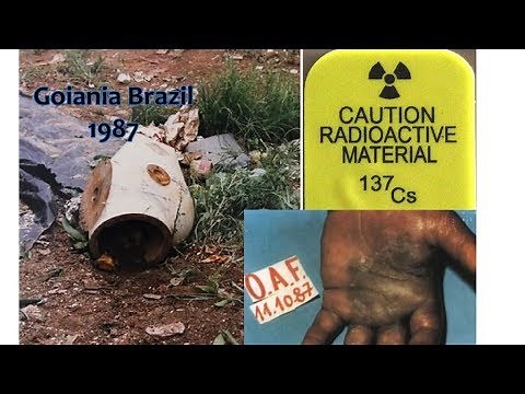 the Goiania Cesium 137 radiological accident