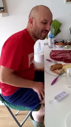 Side Effects L-DOPA, Levodopa, PARKINSON JUVENIL.