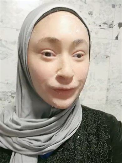 Living with Ichthyosis: Essential Skin Care Tips