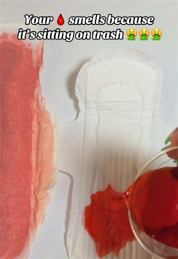 Why Your Period Blood Smells & How to Prevent It