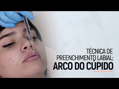 Técnica de Preenchimento Labial: Arco do Cupido | Dra. Bruna Almeida