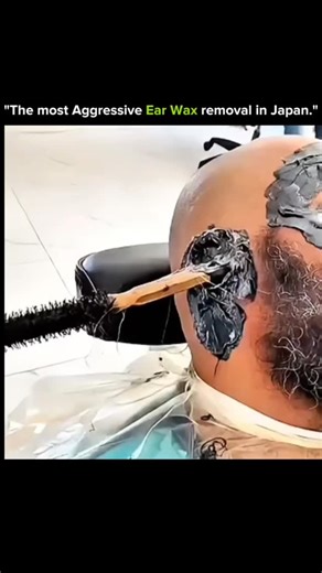 SCIENCE | FACTS | BEYOND | HISTORY | on Instagram: "Japan’s ear-cleaning specialists take precision to another level — but sometimes the buildup is SO intense that it turns into a full-on battle. 🪒 Ultra-sharp micro tools 🔍 High-magnification scopes 🧹 Layer after layer of hardened wax 💥 Satisfying extractions you can almost feel through the screen What looks simple is actually delicate work — one wrong move and the eardrum is at risk. This is ear cleaning, Japanese style. #EarWaxRemoval #Jap