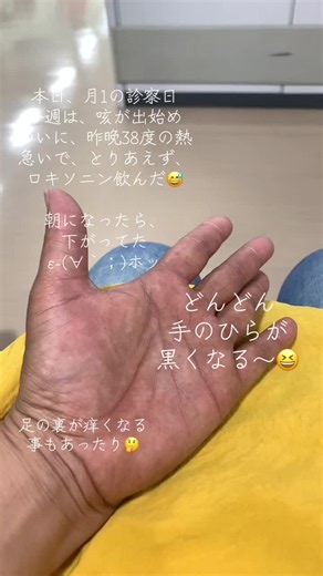 月1診察日｜発熱と咳で受診した記録（38℃から34℃へ）