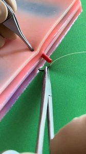 Figure-of-8 stitch for vascular ligation | Dermhacks