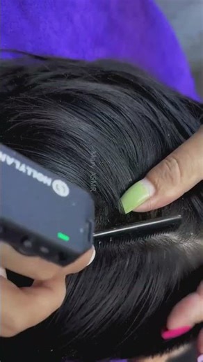 Big Flakes!! Scratching Scalp And Picking Removal