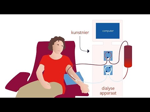 Hemodialysis (blood dialysis)