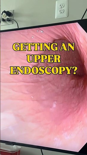 What Happens During an Upper Endoscopy? (EGD Explained)