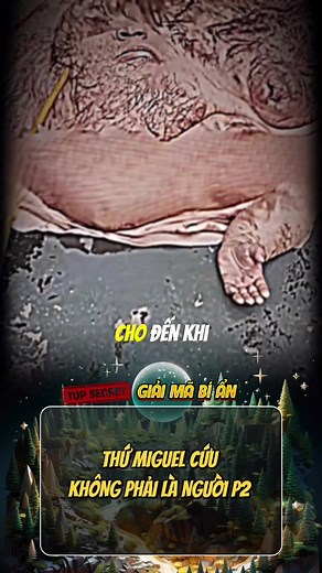 Thứ Miguel cứu không phải là người - P2