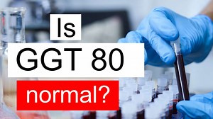 Is GGT 80 normal, high or low? What does Gamma glutamyl transferase level 80 mean?