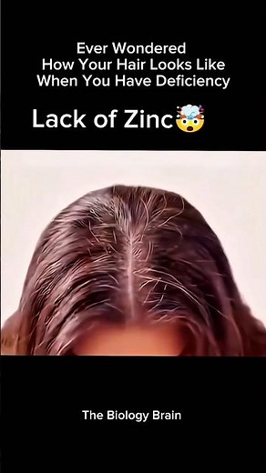 This Is Why Your Hair Is Falling Out (Real Reason) #hairloss #shorts