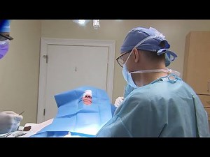 Rare type of skin cancer grows fast, spreads quickly