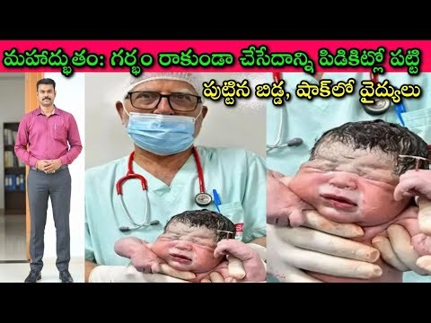 Miracle Baby Birth Control Fail Story: ఇలాంటోడు భూమ్మీద ఒక్కసారే పుడతాడు, అవునా కాదా?😎🥰| SivaPrasad
