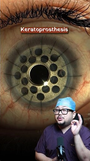 A Last Hope, Artificial Cornea 👁️