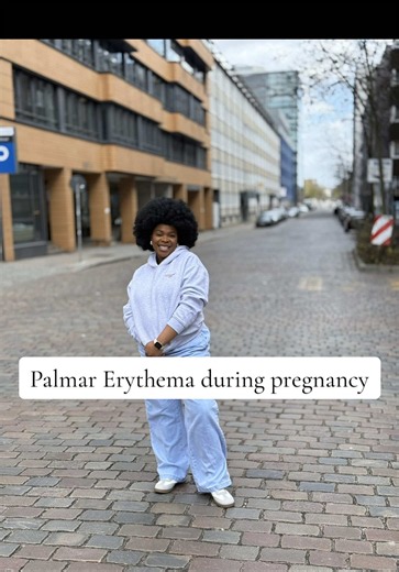 Palmar erythema is redness of the palms. During pregnancy, it is usually caused by increased hormone levels,especially estrogen which increase blood flow to the skin. IT IS USUALLY HARMLESS. And goes on its own! But seek your doctor's attention when it; Itches swollen rashes elsewhere Painful or burning sensation And if you have any liver disease history. #pregnancylife #pregnancysymptomsnoonetellsyouabout #pregnancytiktok #awareness