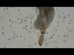 2020 Amoeba attacks dividing paramecia... and eats them