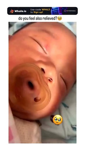 @funnyrrel on Instagram: "The video depicts a newborn baby peacefully sucking on a pacifier as tweezers gently clear mucus from its nasal passage, ending with the infant appearing calm and relieved. - Posted on February 1, 2026, by @corvenav, it quickly went viral with 1.3 million views, 3,500 likes, and hundreds of replies in multiple languages echoing the poster’s emotional relief. - Such clips underscore routine neonatal care to prevent airway obstruction, a common concern backed by pediatric