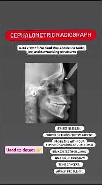 What is Cephalometric radiograph ?
