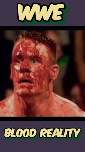 blood in wwe | #wwe #shorts#wwf#wwewrestler #trending #wweindia