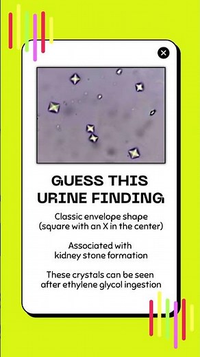 Guess this Urine Finding #6 | Urinalysis Review