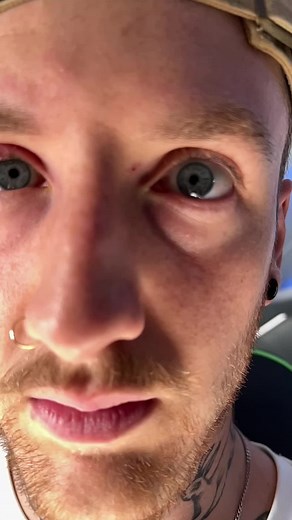 STYE infection update…. 😫 Has anyone seen a stye as bad before??? Finally seeing an optometrist tomorrow 👓