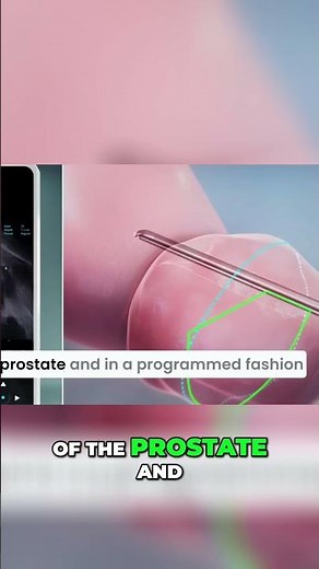 Doctor's Real-time Surgery: See How It Works! Amazing!