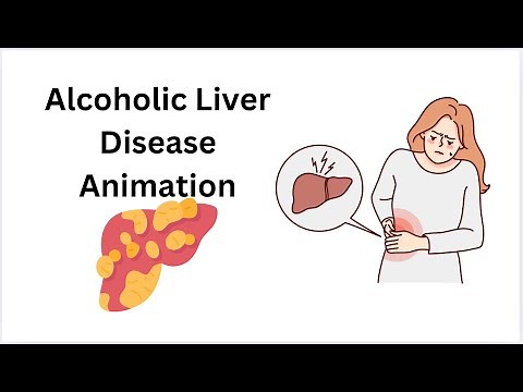 An Animated Guide to Alcoholic Liver Disease: What You Should Know