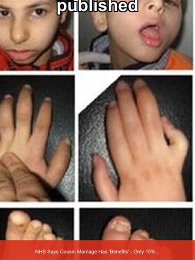 NHS's Controversial Guidance on Cousin Marriage