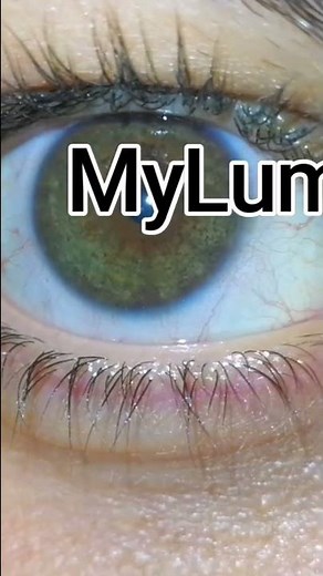 Laser Eye Color Change Surgery before and after #eyecolorchange #beforeandafter