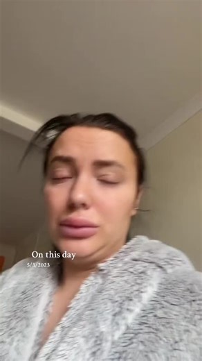 One year eince my new cheeks @Nix.aesthetics the hest about #wales #welsh #viral