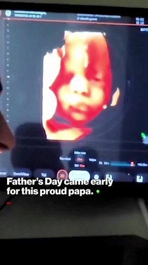 Adorable: 32 week ultrasound shows unborn child smiling at father's voice. | Catholics for Catholics