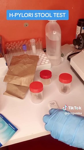Exploring H. pylori Stool Test Process: A Comprehensive Guide