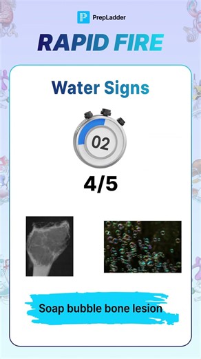90% failed to Guess these Water Signs in Medical! #prepladder #neetpg #inicet
