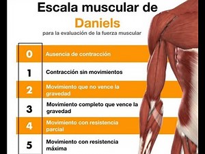 Valoración muscular basada en ESCALA DE DANIELS. miembros superiores e inferiores.