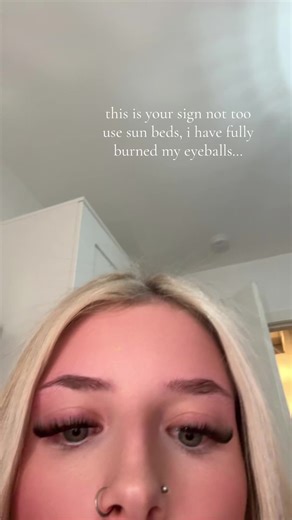 The Dangers of Sunbeds: A Cautionary Tale
