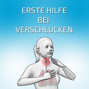 So einfach kann jeder vor dem Ersticken gerettet werden. Reagieren Sie schnell, jede Sekunde zählt, besonders bei Erdnüssen oder Weintrauben, die die Luftröhre genau abdichten! | BAYERN 1