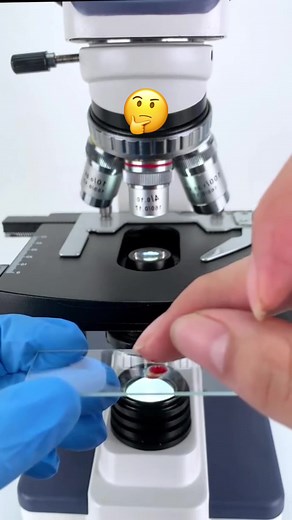 Blood Under the Microscope - See What's Inside