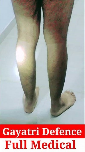 Delhi Police Full Medical II CPO SI II Army II SSC GD II