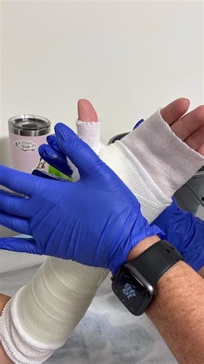 Precision Splinting & Casting on Instagram: "#orthopedics #healthcare #healthcareprofessionals #education #patientcare"
