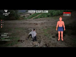 ESX/QB | Bodydamage UI | frozen-scripts.com