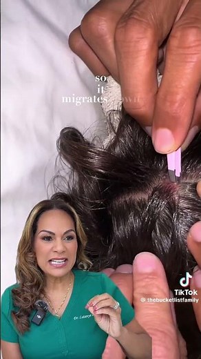 Botfly removal! #dermatology #dermtips #drmommy #botfly