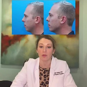 Facial Masculinization Procedures