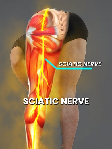 Sciatica Relief: 3 Essential Decompression Techniques