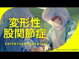 股関節の痛みの原因はこれ｜変形性股関節症と人工股関節手術を解説【整形外科部長が解説】