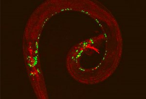 Insight Into the Molecular Basis of Differences in Male and Female Brains | Cell And Molecular Biology
