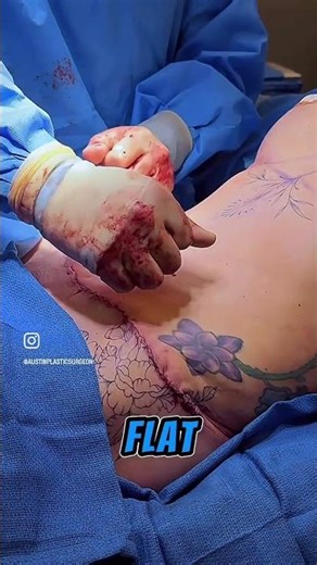 The importance of the belly button!