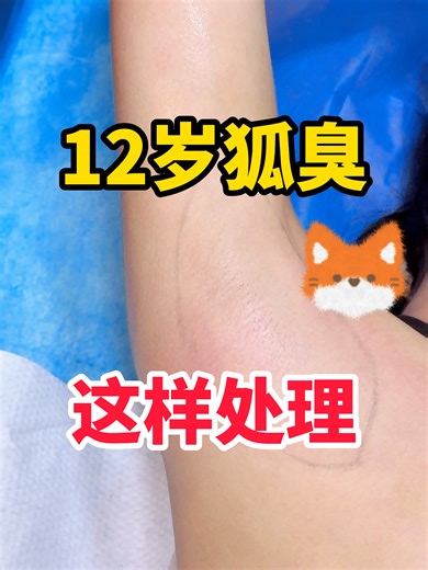 12岁狐臭 这样处理