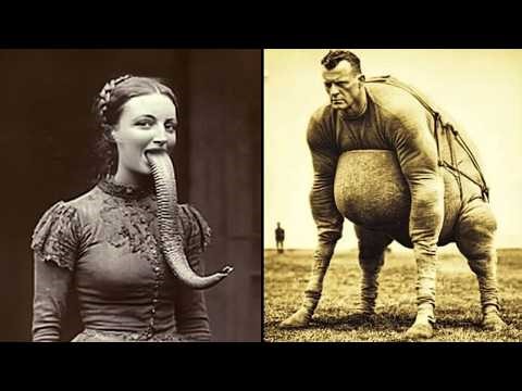 15 Most Shocking Real Circus Freaks Ever Lived
